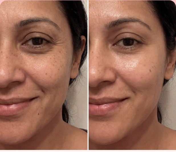 Customer result