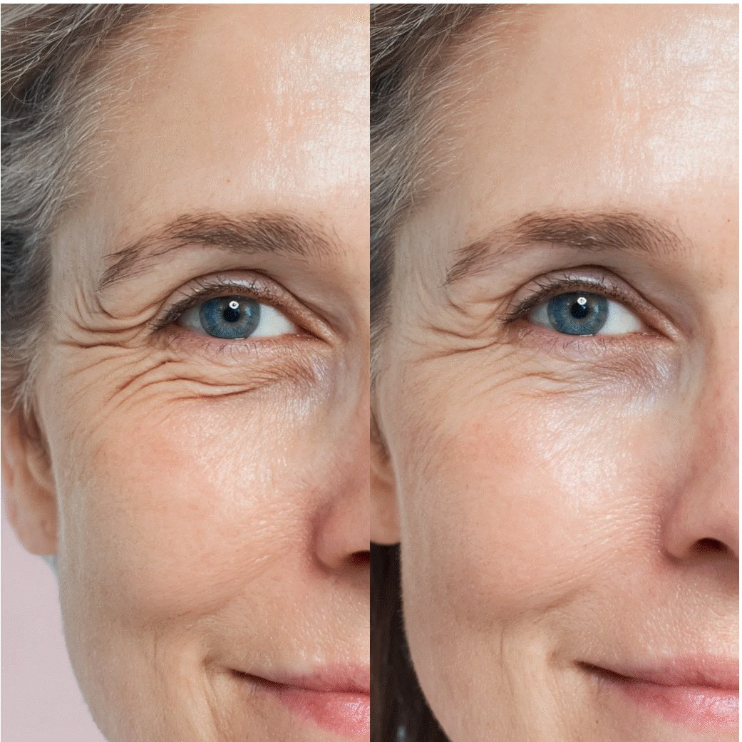 Before and after results